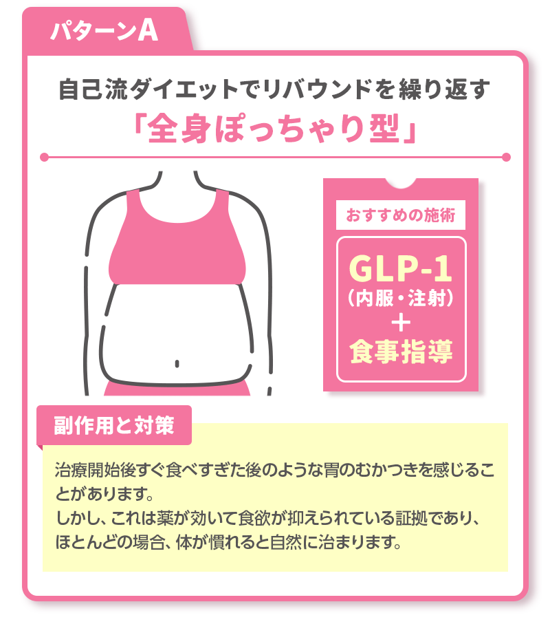 パターンA：自己流ダイエットでリバウンドを繰り返す「全身ぽっちゃり型」
