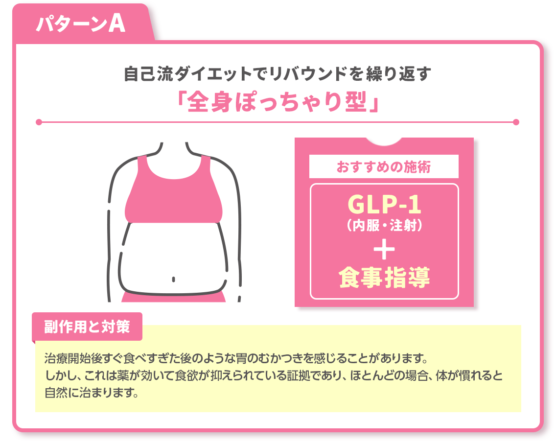 パターンA：自己流ダイエットでリバウンドを繰り返す「全身ぽっちゃり型」
