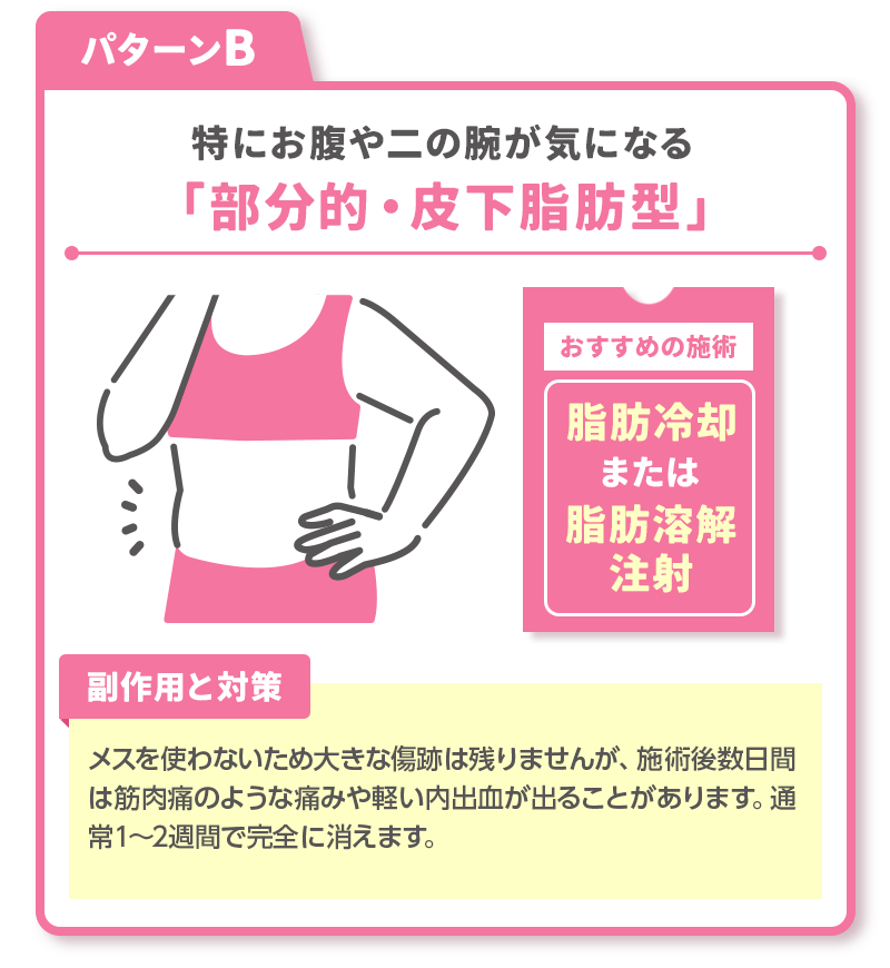 パターンB：特にお腹や二の腕が気になる「部分的・皮下脂肪型」